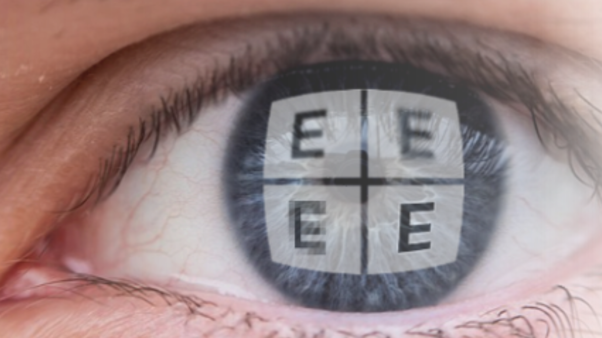 eye